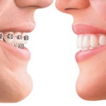 Dentista Alcala Henares 1 Clinica Dental Ortodoncias Invisibles Brackets