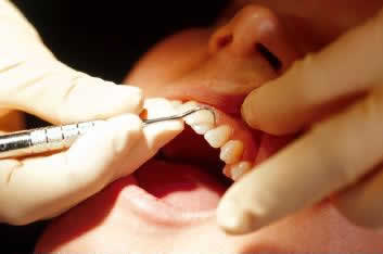 Dentista Alcala Henares | Clinica Dental Odontologos Ortodoncias Periodoncias Implantes Estetica Dental Empastes y Cirugias