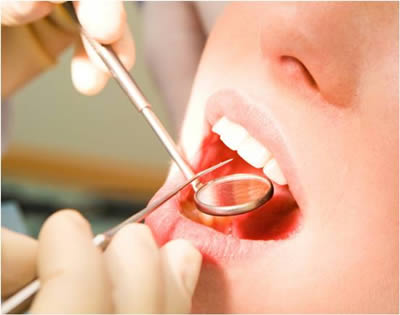 Dentista Alcala Henares | Odontologia Conservadora, Empastes, Tratamiento, Diagnostico en Muelas y Dientes