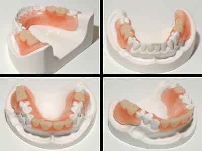 Dentista Alcala Henares | Clinica Dental Protesis Dentales Fijas Combinadas Implantes Dentista Alcala Henares | Clinica Dental Protesis Dentales Fijas Combinadas Implantes