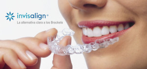 Invisalign orthodontist Alcala Henares | La Garena Dental Clinic 